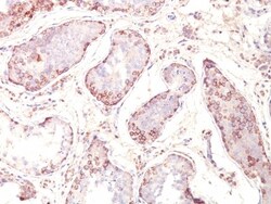 MAGEA1 Antibody (MZ2E/838), Novus Biologicals 0.2mg; Unlabeled:Antibodies,